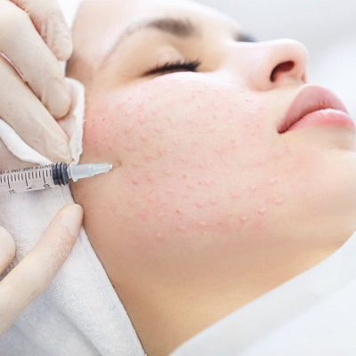 Tone and Tighten: Mesotherapy Treatments in Dubai