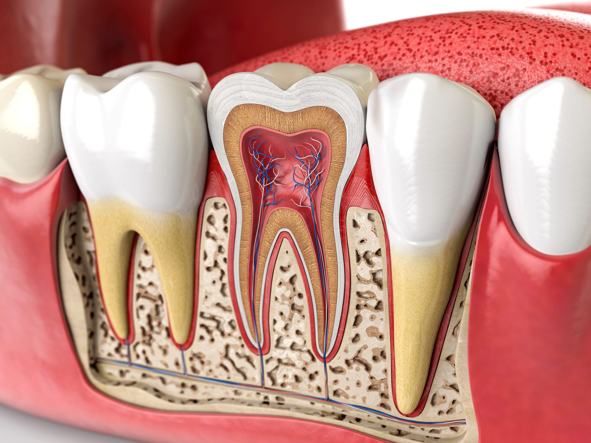 Root Canal for Sensitive Teeth: Is It the Right Treatment for You?