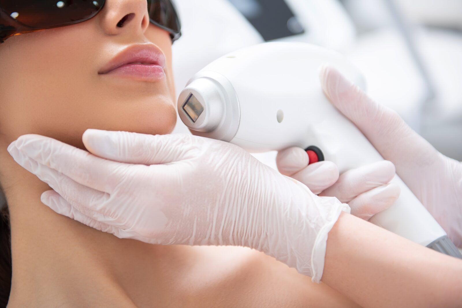 Why I Chose Fractional CO2 Laser Over Botox in Dubai