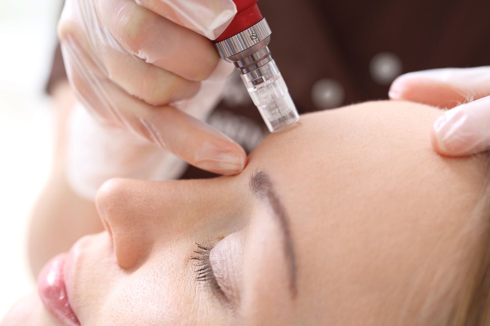 Mesotherapy for Working Moms in Dubai
