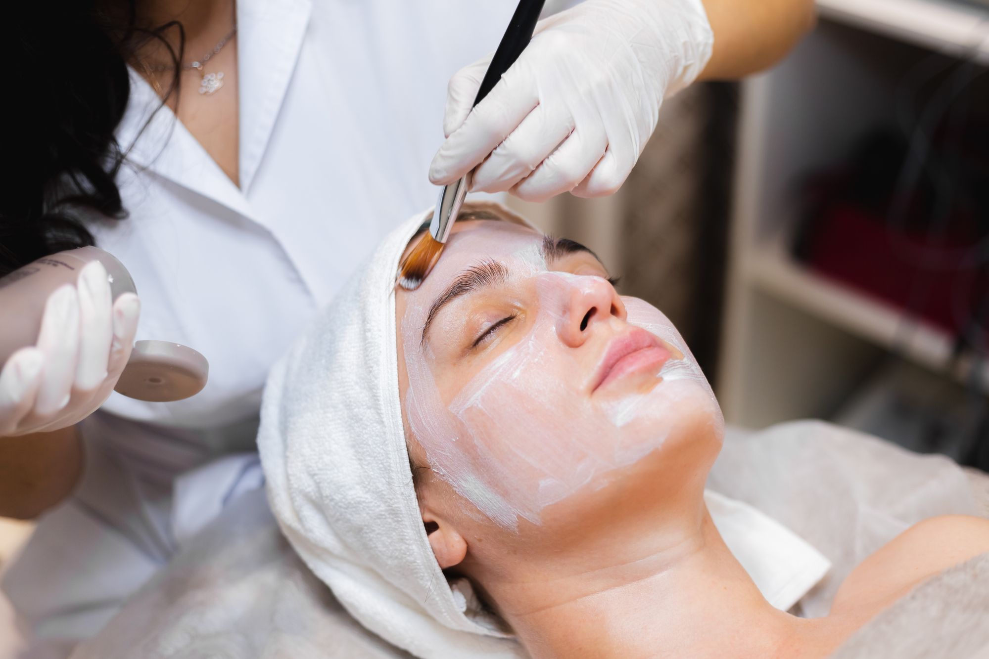 Top Benefits of Chemical Peel in Dubai