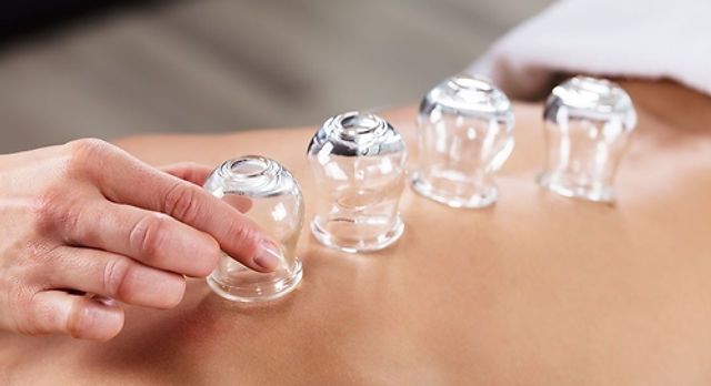 How Long Does Hijama Cupping Therapy in Dubai Take?
