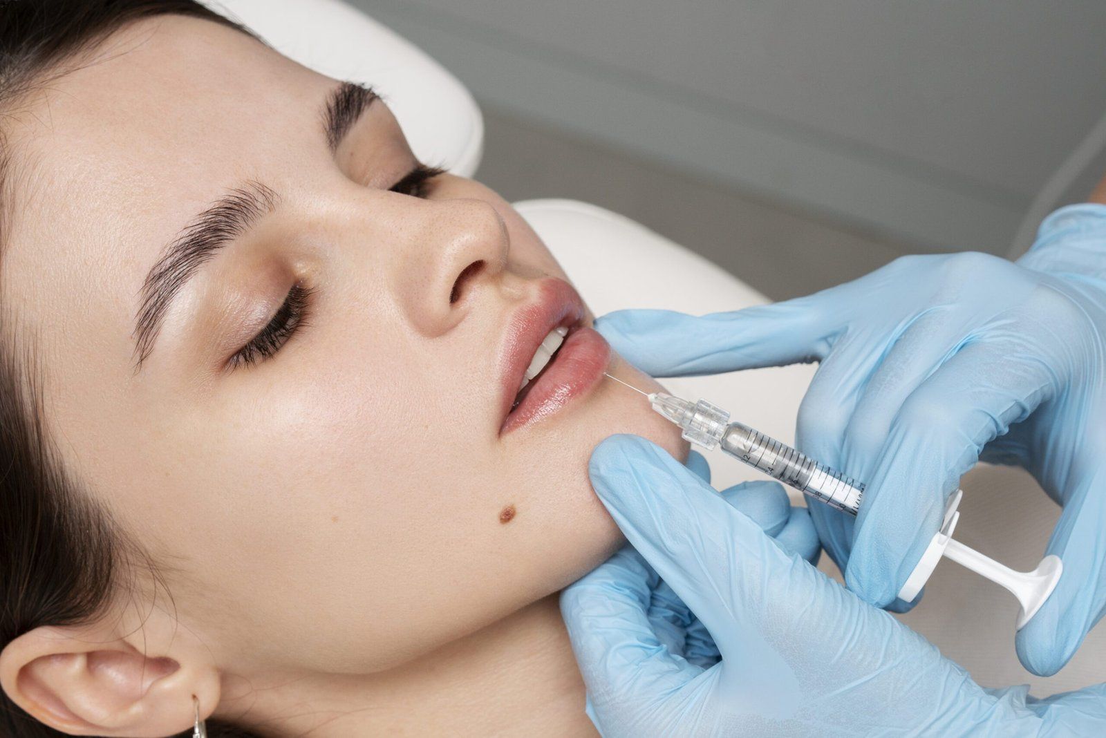 Who Is Eligible for Laser Treatment for Dark Lips in Dubai?