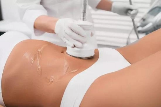 When Do You See Final Results from Laser Liposuction in Dubai?