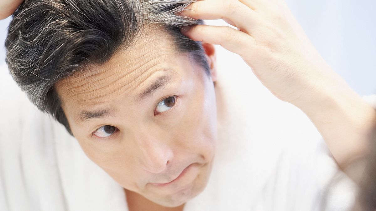 Who Achieves Best Results With Hair Replacement in Dubai?