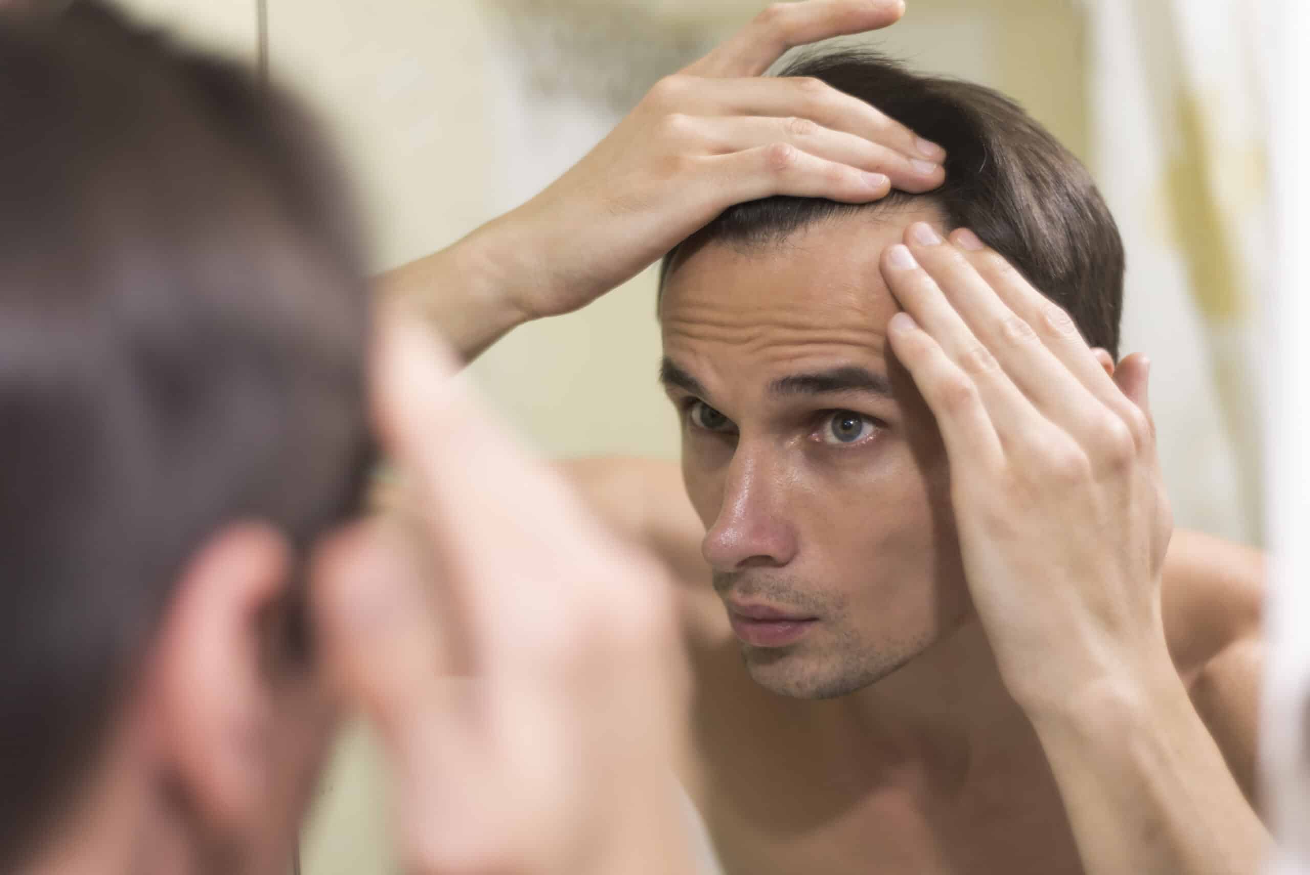 What Are Expert Solutions for Hair Loss Treatment?