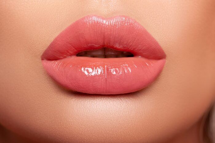 How to Prepare for Russian Lip Fillers in Dubai?