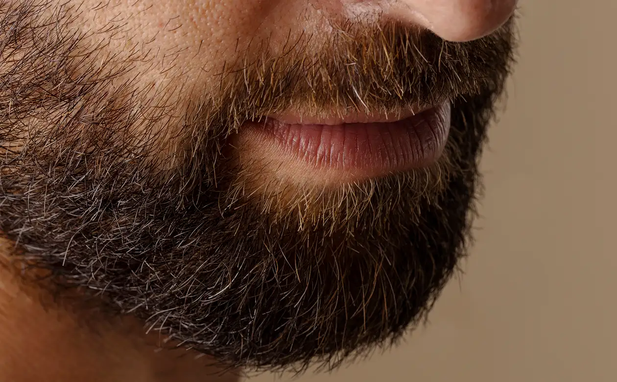 How Does Beard Hair Transplant in Dubai Improve Confidence