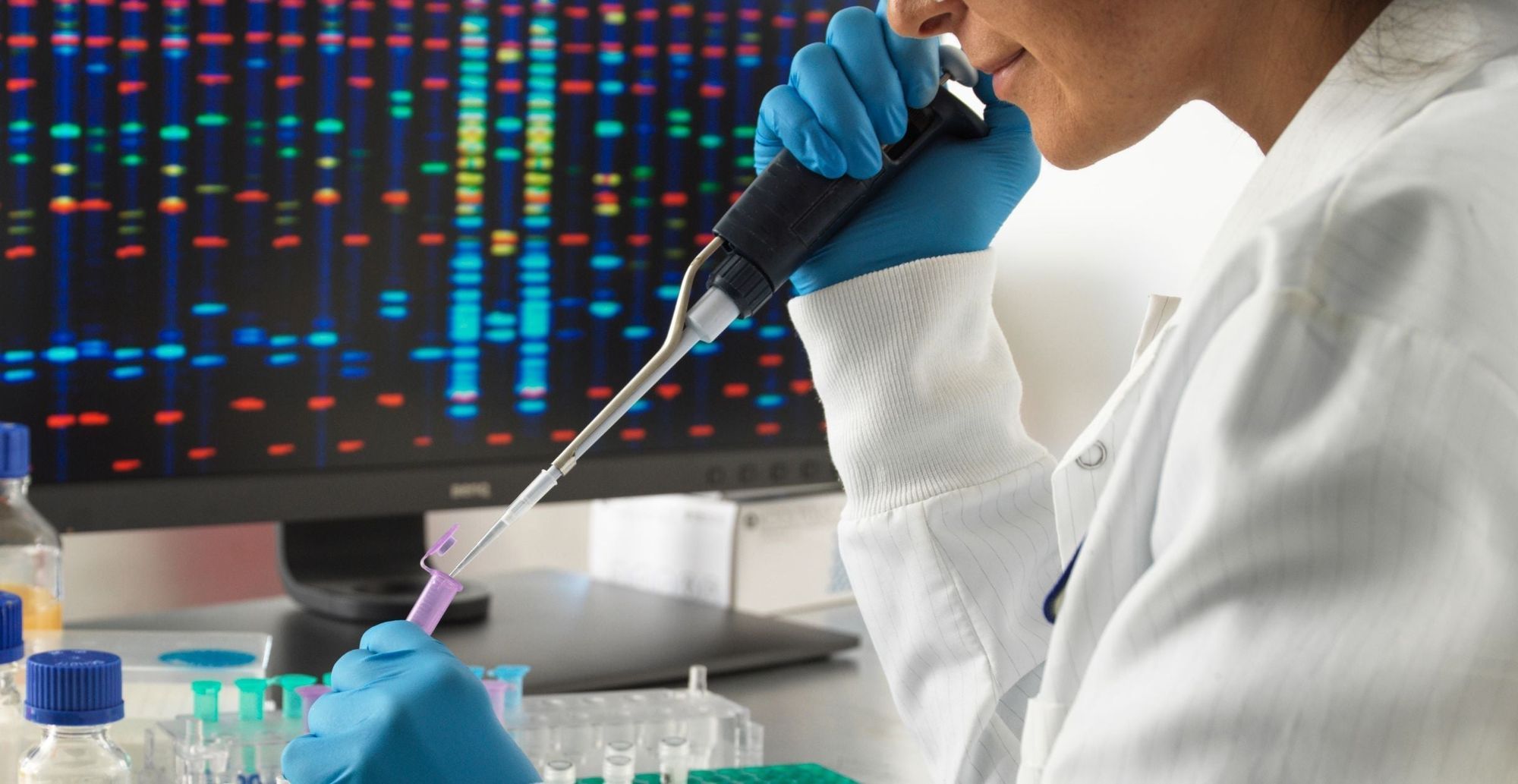 What Results from DNA Nutrition Test in Dubai?