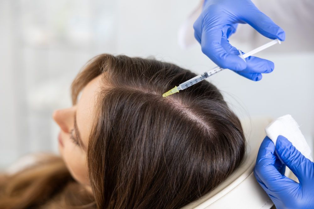 Why Is Best PRP Hair Treatment in Dubai Trending