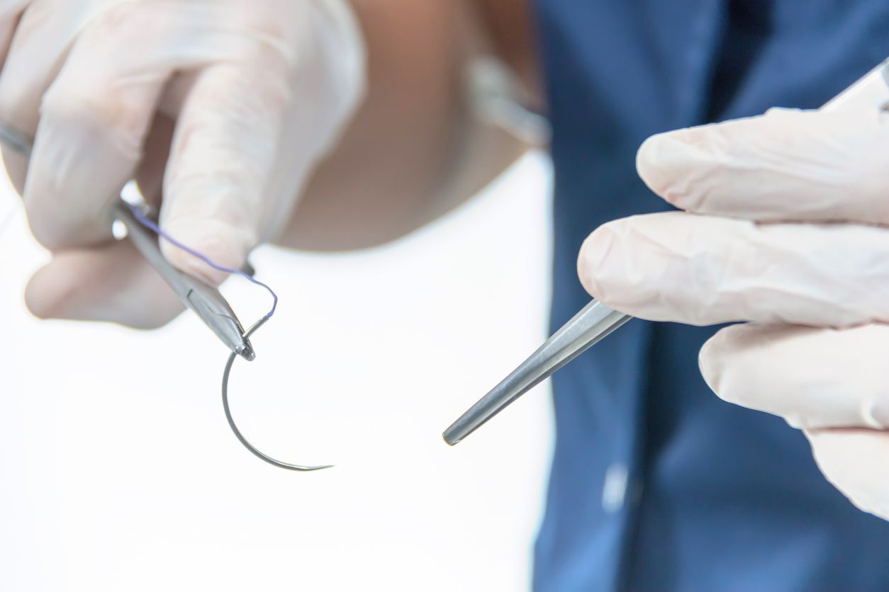 Suture Removal at Home in Dubai Explained Step by Step