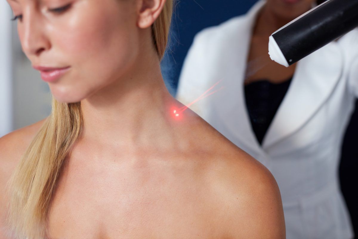 Safe Skin Solutions Why Laser Warts Removal Is Popular in Dubai Clinics?