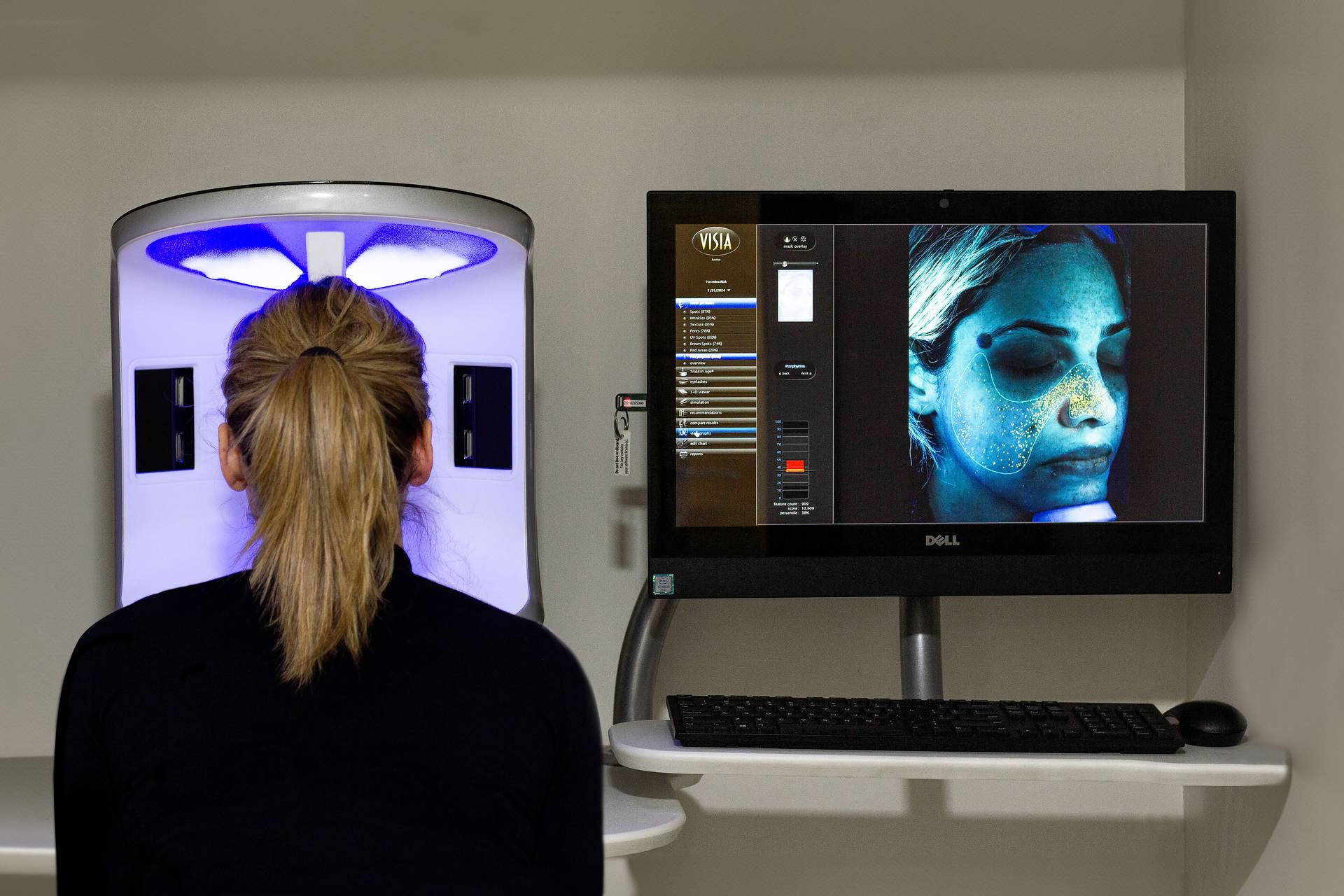 VISIA Skin Analysis in Dubai How does skin mapping assist?