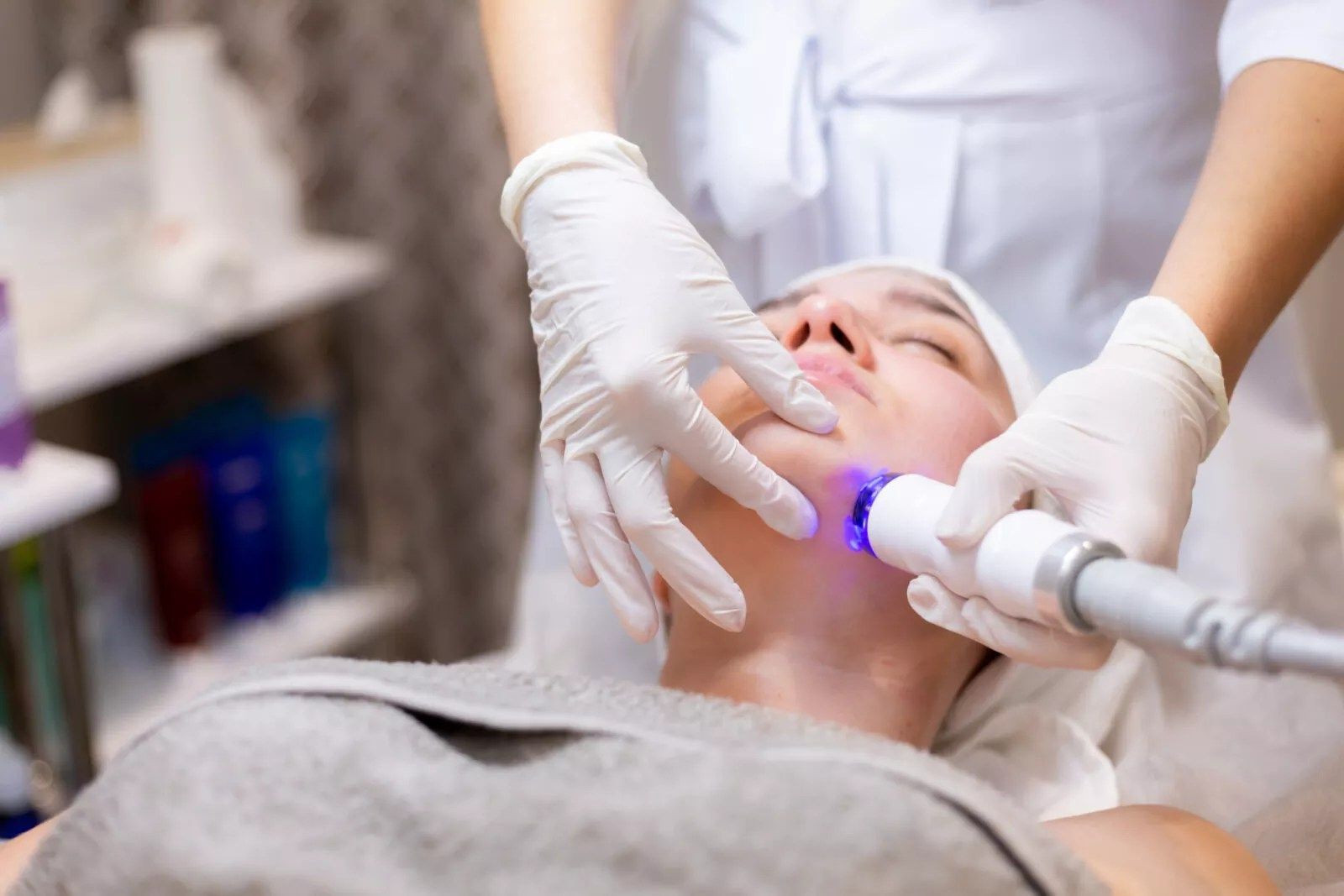 Can Fractional RF Microneedling Treat Hyperpigmentation?