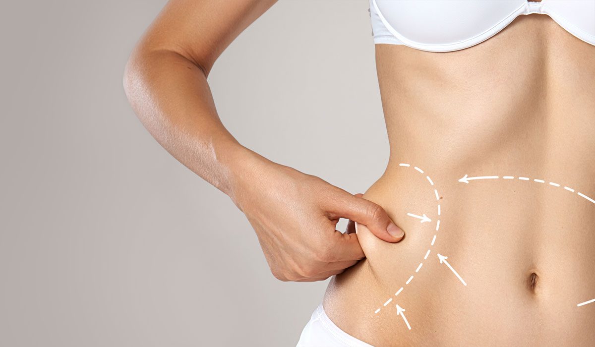 What Lifestyle Changes Support Plastic Surgery Tummy Tuck Dubai?