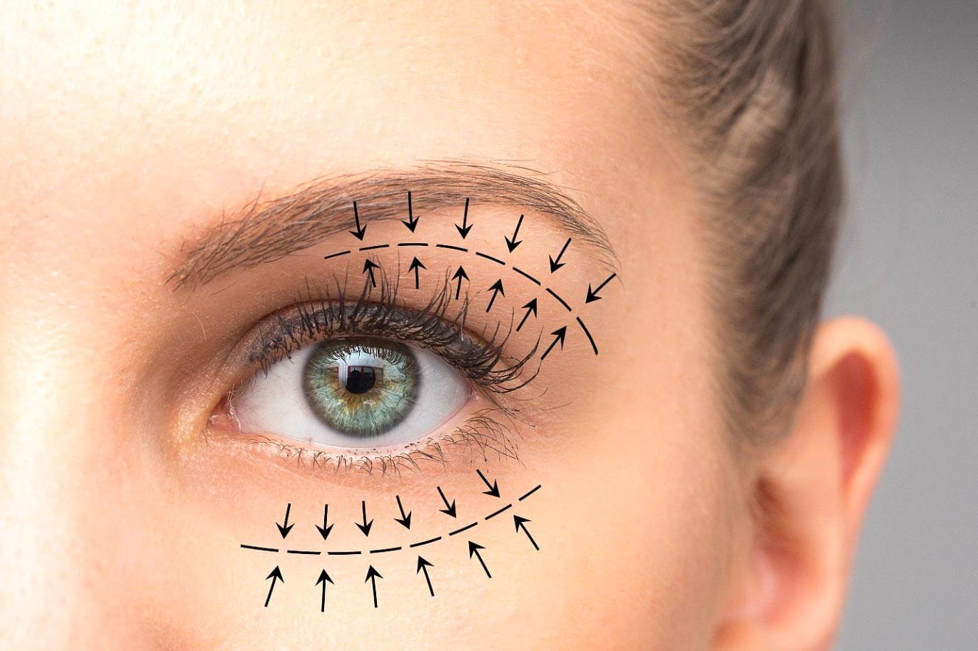 Best Medical Experts for Eyelid Surgery Dubai Price