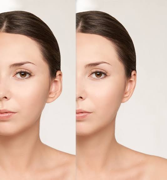Top Wellness Clinics for Ear Reshaping Surgery in Dubai