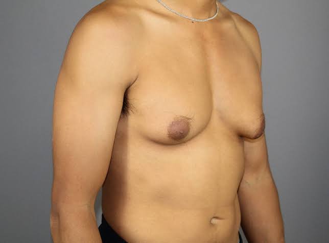 Top Clinics for Personalized Gyno Surgery Dubai